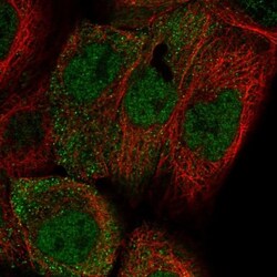 APM2 Antibody, Novus Biologicals:Antibodies:Primary Antibodies